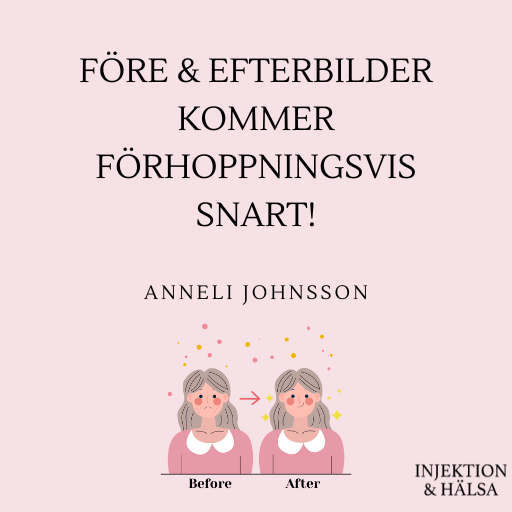 MALL-512x512-fore-och-efterbilder